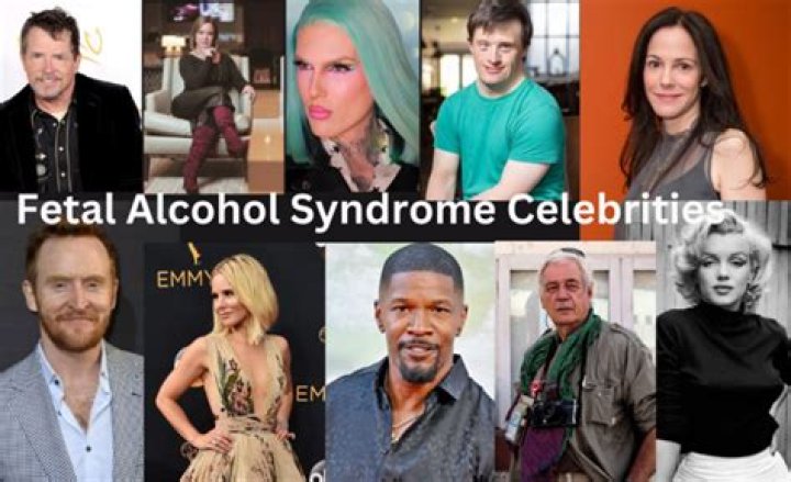 Celebrities Plagued By Fetal Alcohol Syndrome