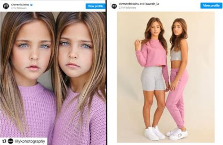 Exploring The World Of Famous Twins: Their Age And Impact