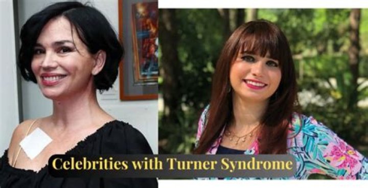 Inspiring Stories Of Female Celebrities With Turner Syndrome
