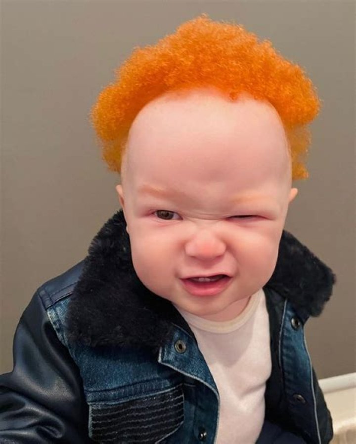 Understanding The Unique Beauty Of Ginger Albino
