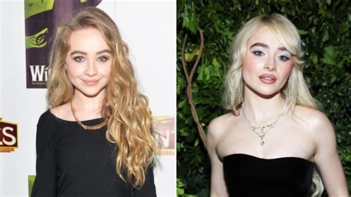 Unveiling The Truth: Has Sabrina Carpenter Had Surgery?