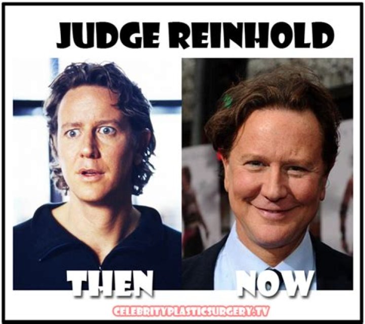 Unveiling The Truth Behind Judge Reinhold And Botox