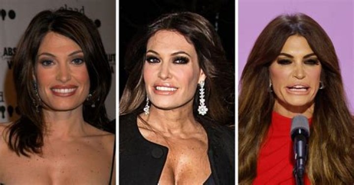 Transformations Unveiled: Kim Guilfoyle Before And After