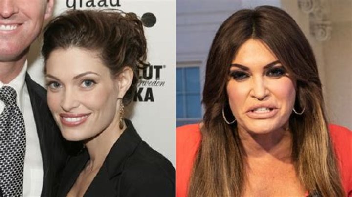Why Kimberly Guilfoyle Looks Bad: An In-Depth Analysis
