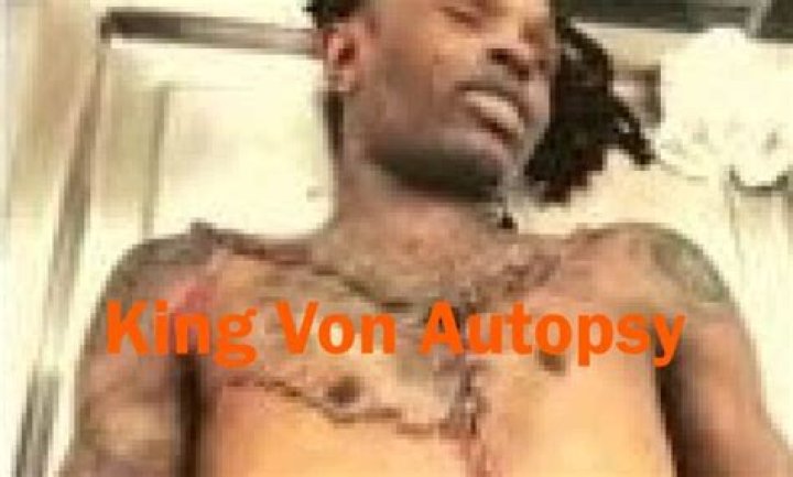 Unraveling The Mystery: King Von Leaked Autopsy