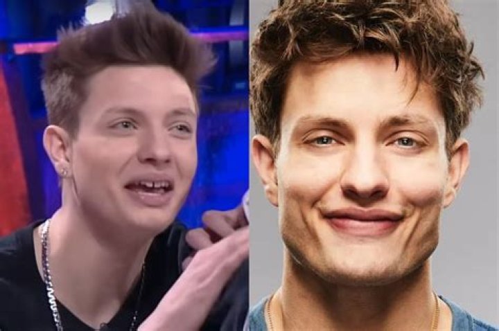 Transformative Smile: Matt Rife Teeth Before And After
