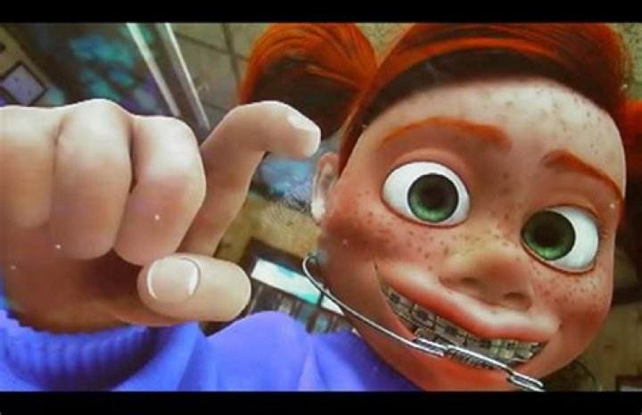 Nemo Girl With Braces: A Unique Journey Of Transformation