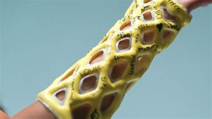 Nunes' Broken Arm: The Story Behind The Injury