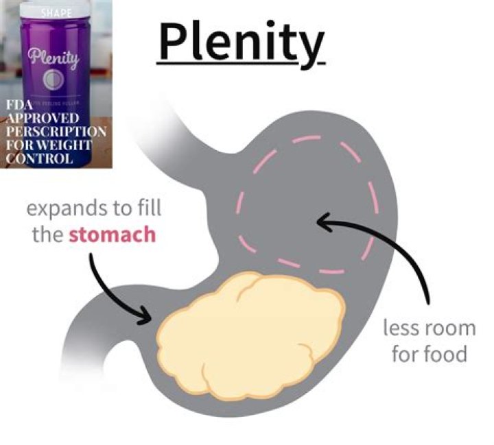 Before & After Plenity Weight Loss Pictures