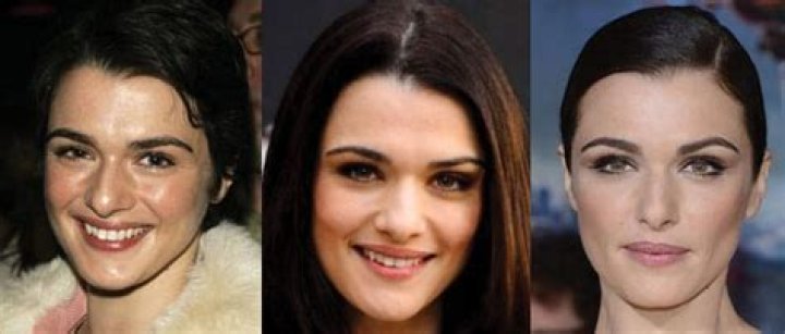 Rachel Weisz Plastic Surgery: Did She Or Didn't She?