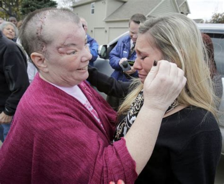 Sharon Budd Accident: A Journey Of Resilience And Recovery