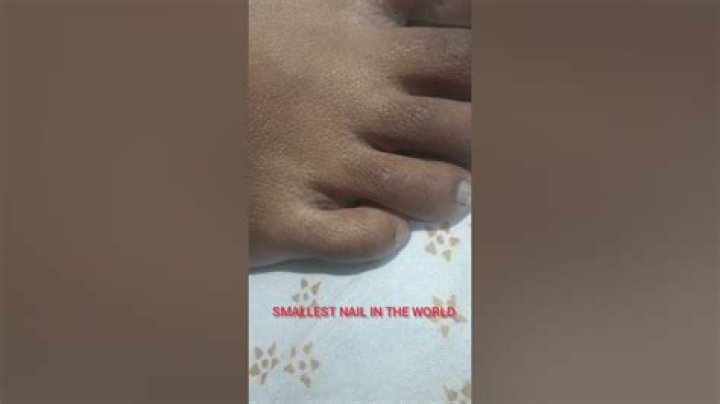 Discovering The Smallest Nail In The World: A Fascinating Journey