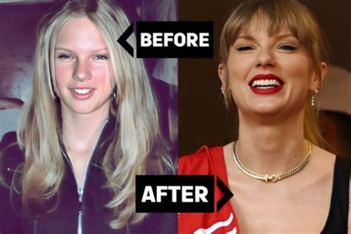 The Astonishing Transformation: Taylor Swift's Weight Loss Journey Unveiled