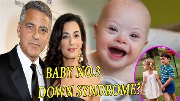 Unraveling The Truth: Does George Clooney Have A Son With Down Syndrome?