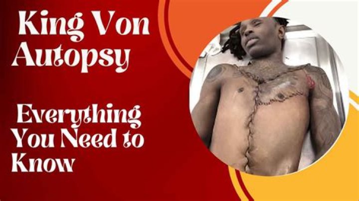 Unraveling The Mystery Of The Von King Autopsy